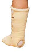 Heel / Elbow Slip Over